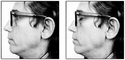 FFOTO-Arnaud Maggs-Christo, Eyes Open / Christo, Eyes Shut